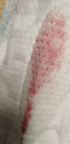 Blood Aftr IE