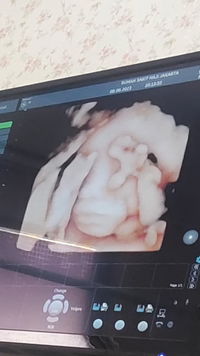 syadilaa profile icon