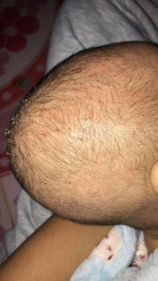 ขอคำแนะนำแม่ๆหน่อยค่ะ