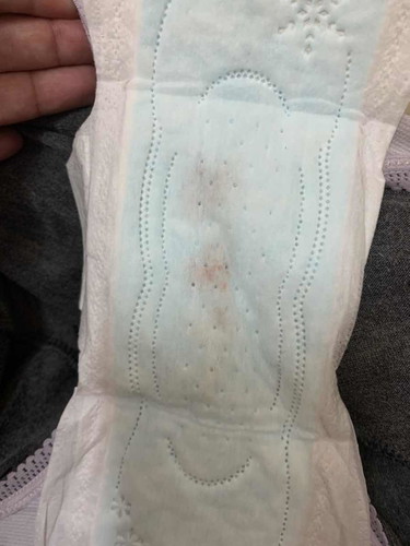 มีเลือดออก ทำยังไง