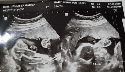 baby girl...