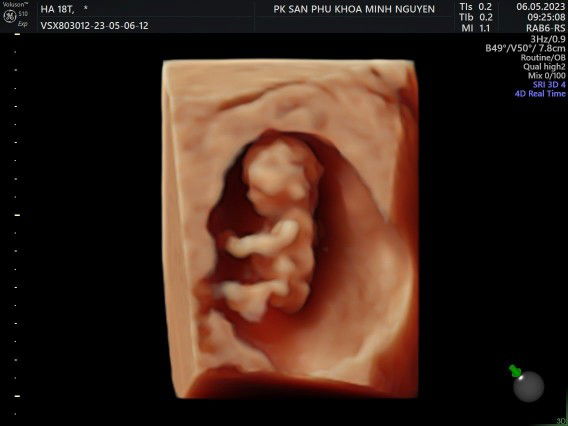 Ngân Hà profile icon