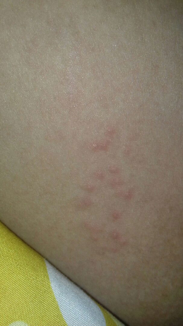 kulitku kenapa? hamil 25 week