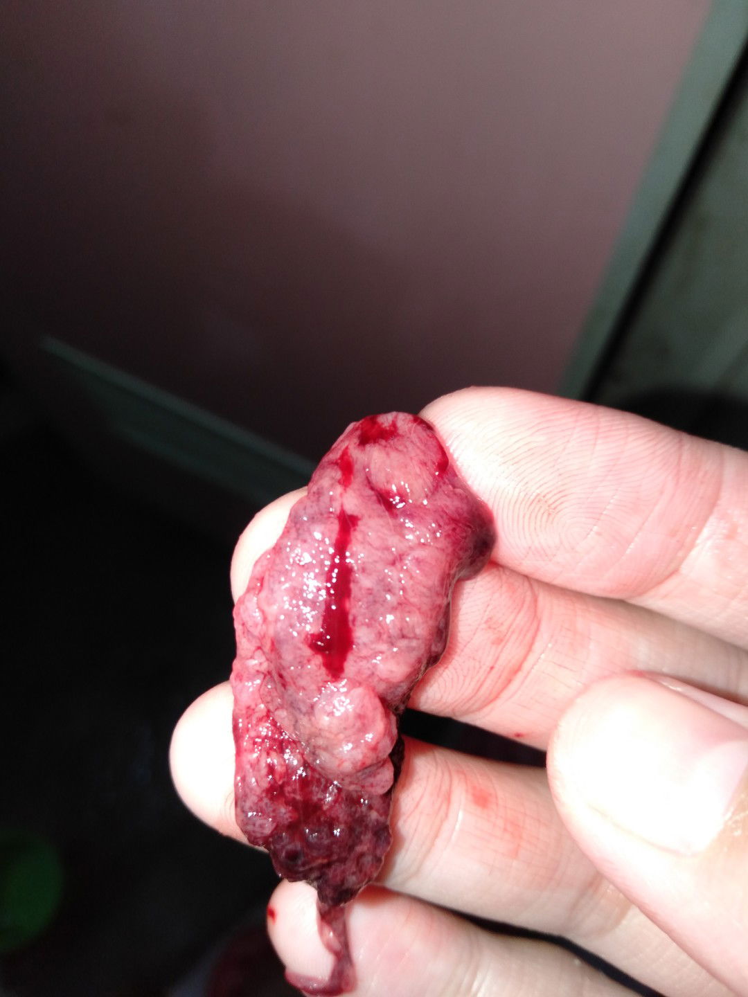 keluar gumpalan kayak daging