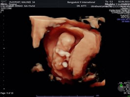 Mareenee Sareeha profile icon