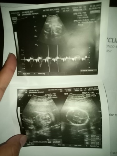 Baby boy ultrasound?