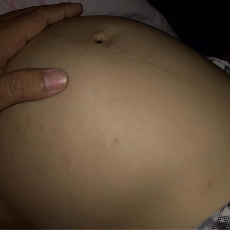 22 weeks ดิ้นเก่งมาก กลางคืนไม่ยอมนอน