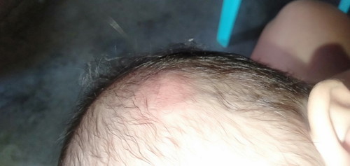 head