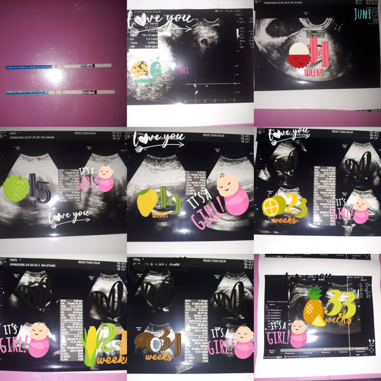 PERJALANAN KEHAMILAN ANAK KE4