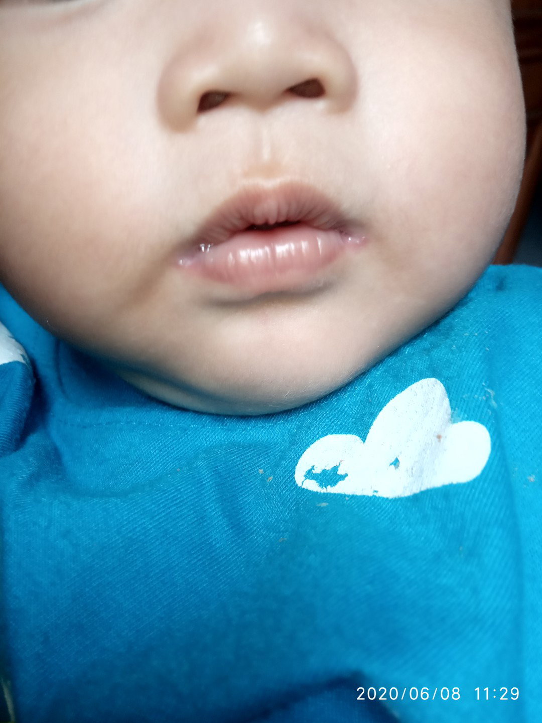 merah merah ujung bibir