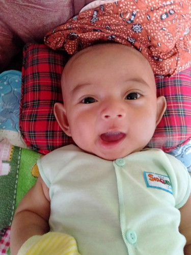 lidah putih