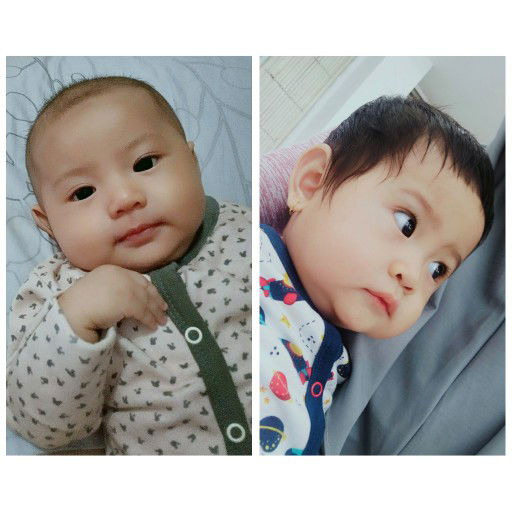 Si botak kesayangan ku sudah berambut