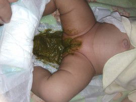 Lanjutan Dari Pertanyaan Saya Semalem Soal Warna Pup