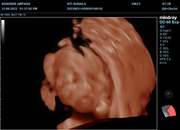 Ummi Aisyah profile icon