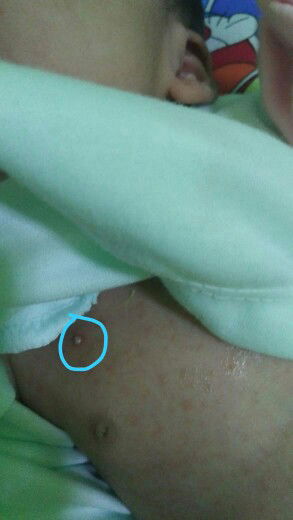 Bintil Putih di badan, leher, kepala.. kenapa ya?