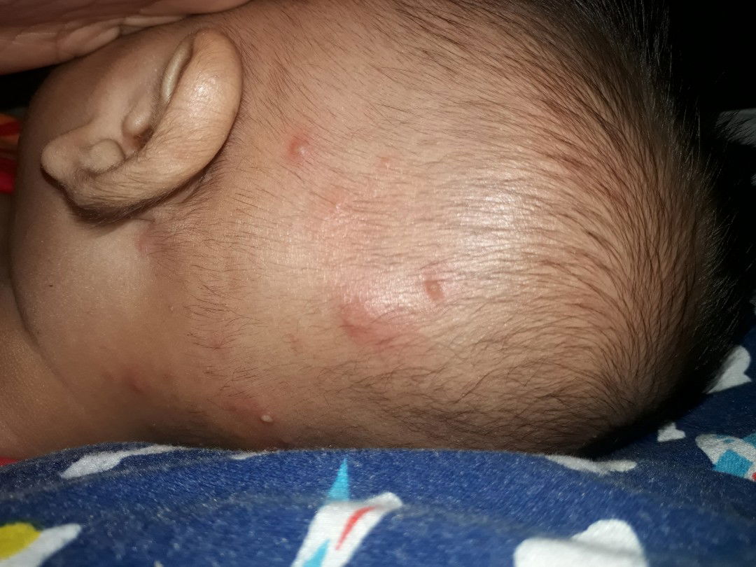 dikasih obat apa ya mom