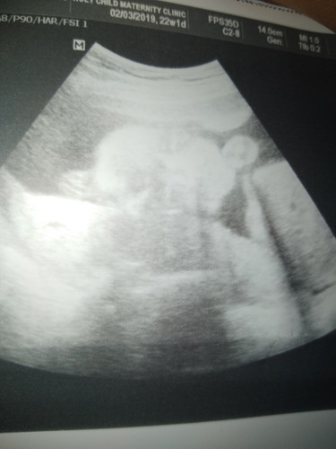 My Baby