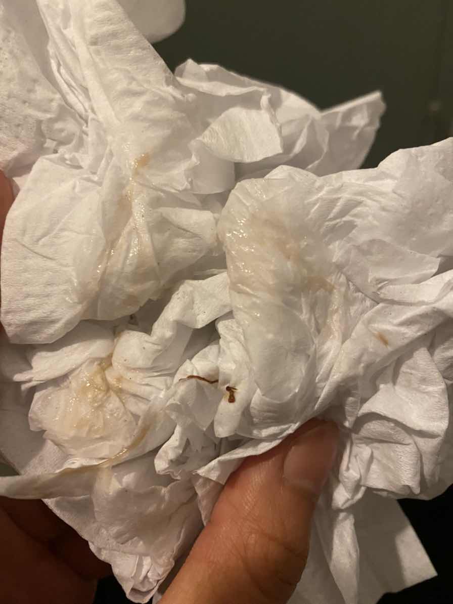 มีมูกปนเลือด นับจากวันที่มีประจำเดือน 14วันพอดีค่ะ ประจำเดือนมา13-17