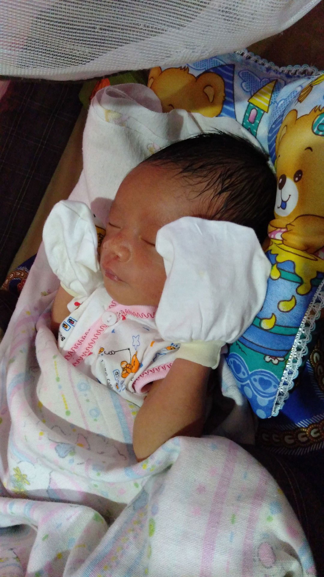 Sedih karena operasi sesar