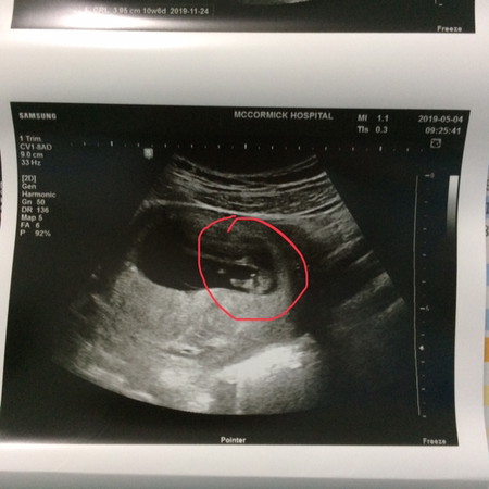 ช่วยดูเพศให้หน่อยค่ะแม่ๆ