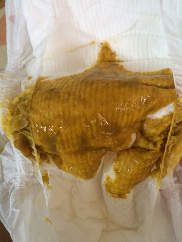 อุจระลูกปกติไหมค่ะ ลูก 2เดือน 23วัน