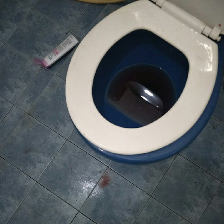 ริดสีดวง