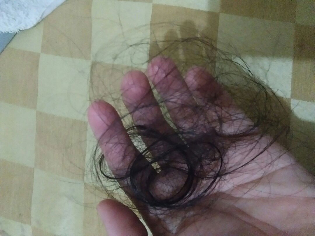 Hair loss