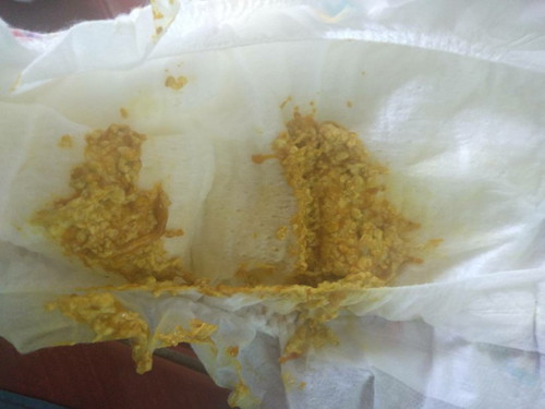 ลูกถ่ายมูกป่นฝอยเลือดออน่ๆ