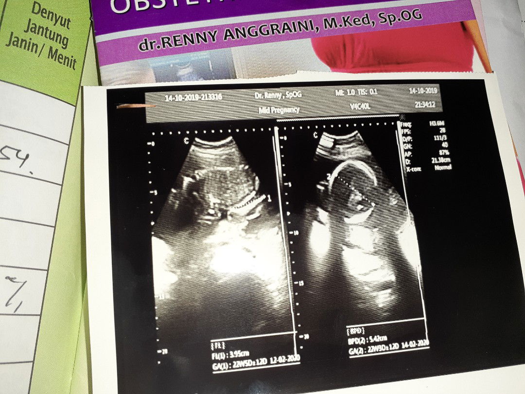 bidan vs dokter kandungan