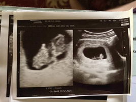 Ayu Dwi Setiani profile icon