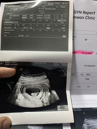 ธิดารัตน์ คำจันทร์ profile icon