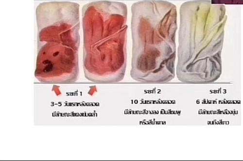 นํ้าคาวปลามีกลิ่น