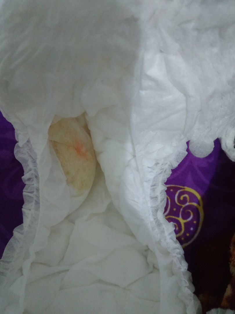 Pipis ada warna oren atau ke pink