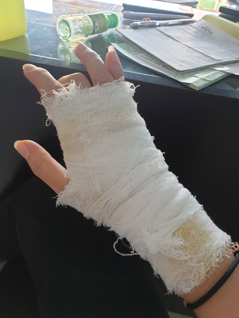 tari tengah tidak bisa di luruskan..