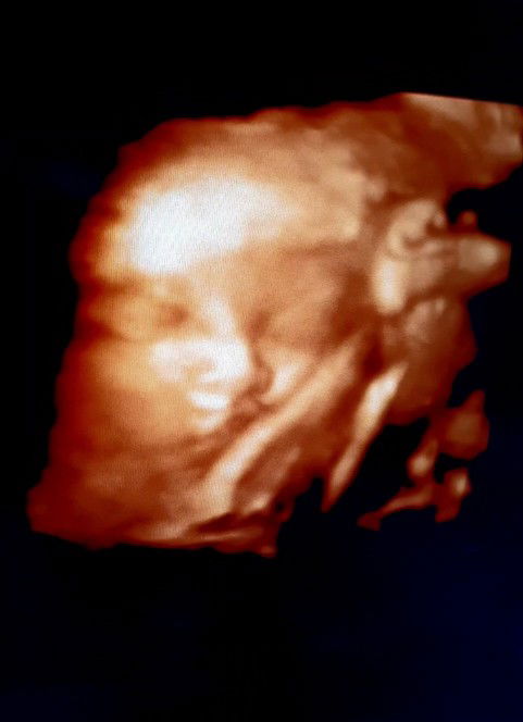 Kittiya profile icon