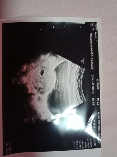 Baby 6w5d