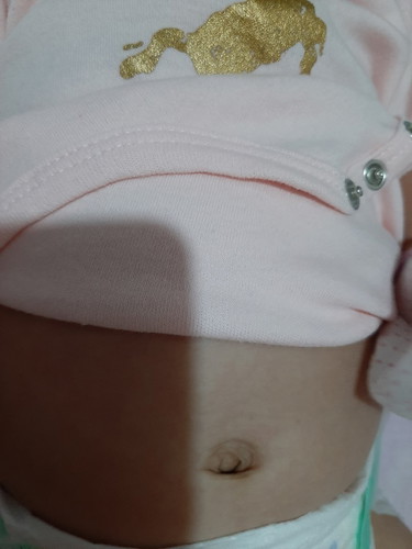 ganyan na ba tlga belly botton ng baby?