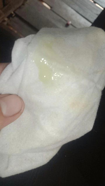 38สัปดาห์1วัน มีสีขาวขุ่นเเบบนี้ผิดปกติมั้ยค่ะ