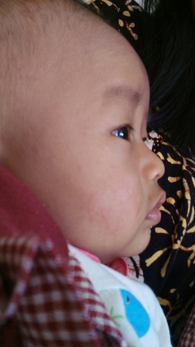 pipi bayi merah dan kasar