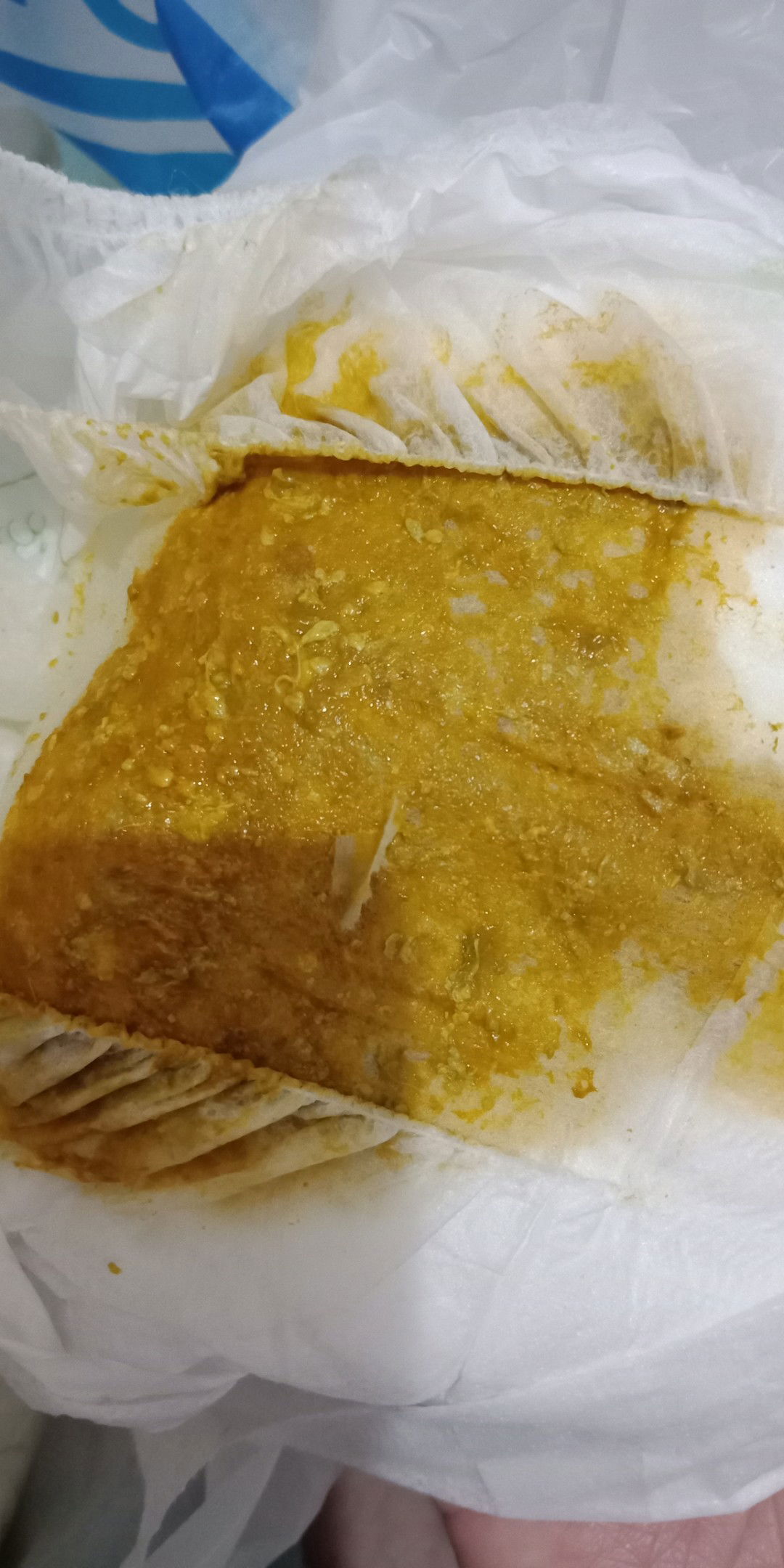 POOP pada bayi umur 1 bulan