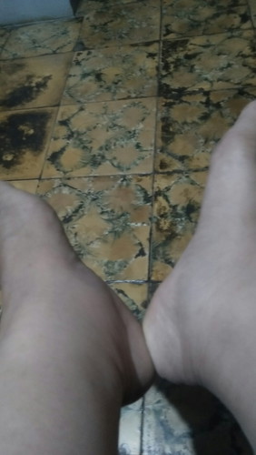 kaki bengkak saat hamil
