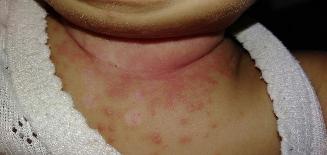 Merah dibagian leher