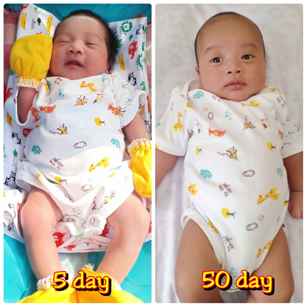 perubahan bayi