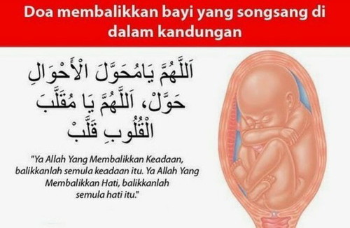 Doa untuk bayi songsang