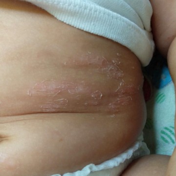 Kulit bayi