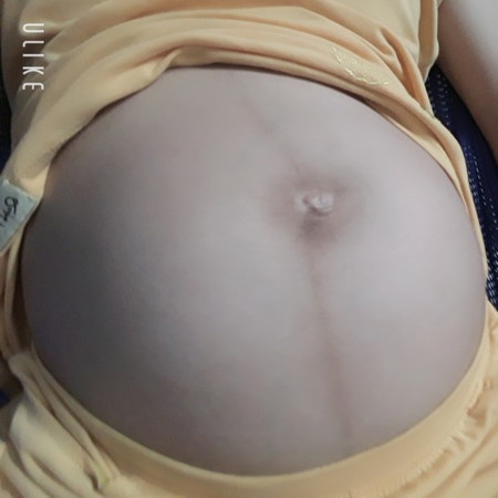 Chuyen bau bi