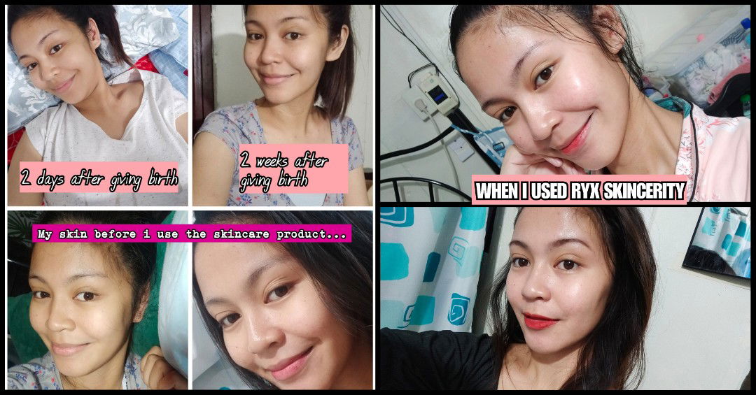 My skincare after giving birth