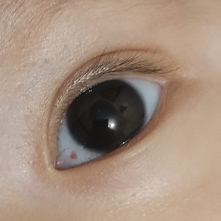 Red Dot in the eye. Help!!!!!!
