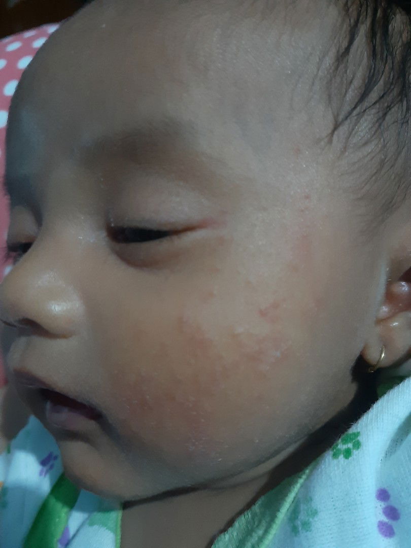 Saran untuk pipi bayiku