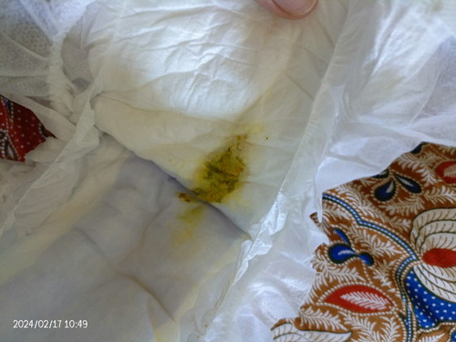 Baby perut sentiasa kembung.. Ape susu yang sesuai?